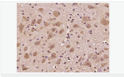 60584987aa4e4.png image.png