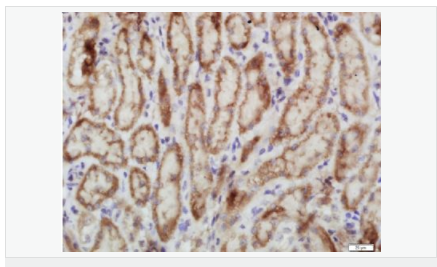 6063d1c58ac2f.png image.png