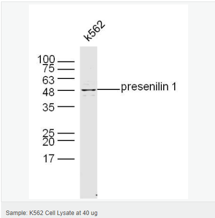 60641717826ae.png image.png