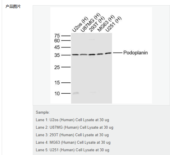 6078fb123f80f.png image.png